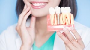 The Comprehensive Guide to Understanding Dental Benefits